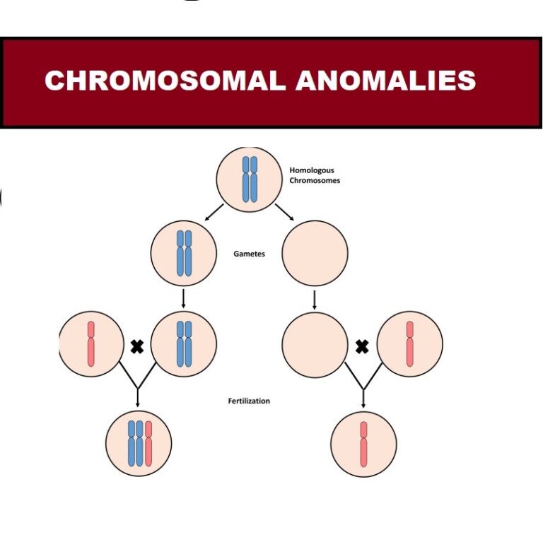 Chromosomal Anomalies